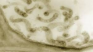 El espiroplasma.(1972)