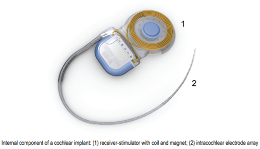 The First Multichannel Cochlear Implant was Developed