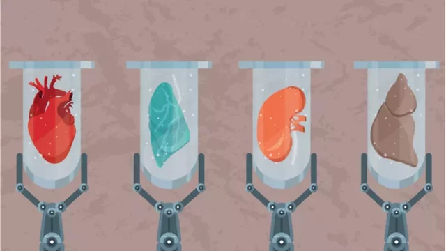 Artificial organs