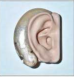 BTE Hearing Aid is introduced
