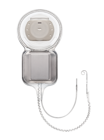 FDA approves Nucleus 22 Cochlear Implant