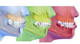 Timeline: Historia de la oclusión