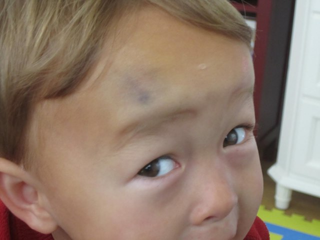 Near Death Expierence.