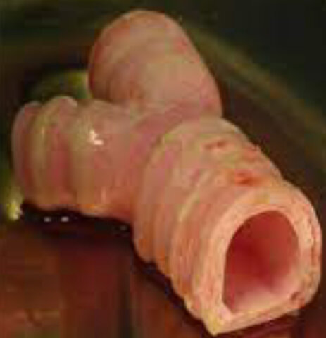 Lab Grown Body Parts