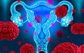 Conocimiento del cáncer de cuello uterino