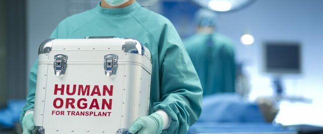 Artificial organs
