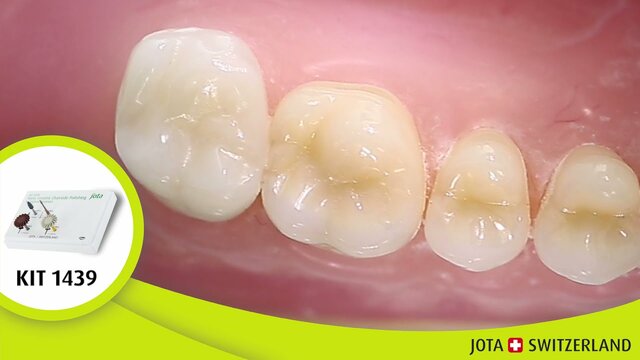 La cerámica fue creada