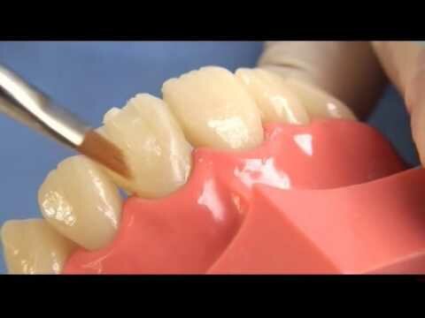 Resinas de nanorelleno