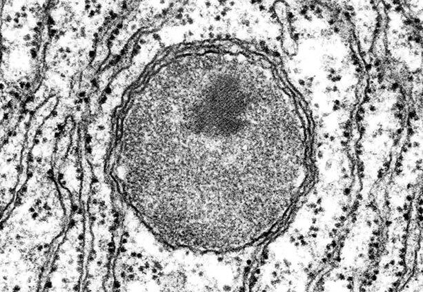 Descubrimiento del organelo peroxisoma