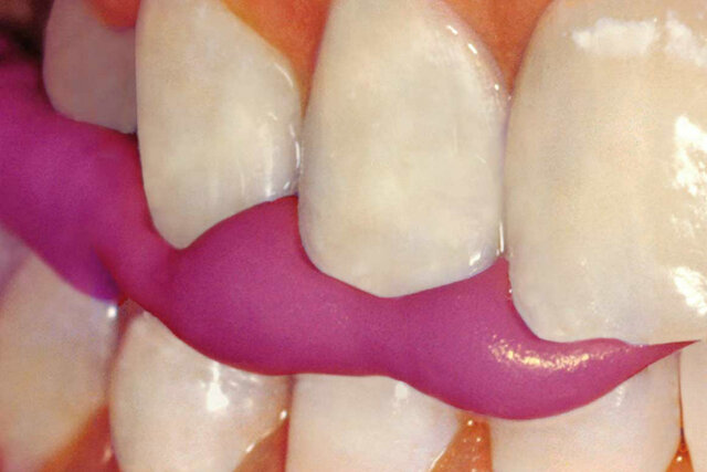 Impresiones con cera