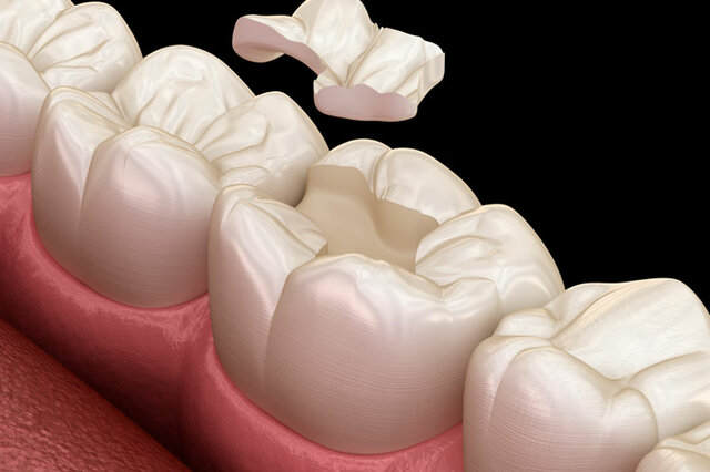 Refinamientos y mejoras