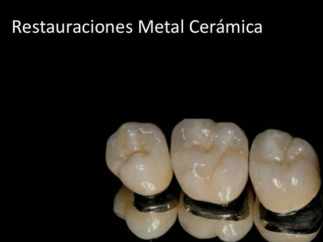 Sistema de metal cerámica