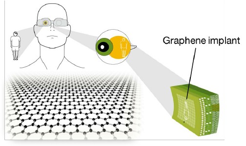 Implantes bioelectrónicos de retina basados en grafeno