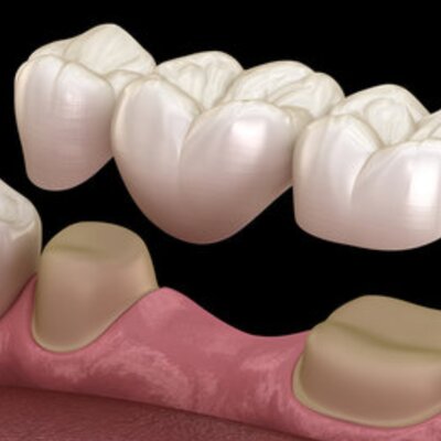 Timeline: Odontología restauradora