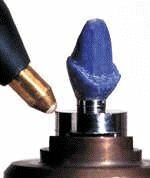 Se introdujeron las restauraciones de cerámica sin metal Procera