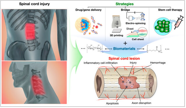 Terapias para el tratamiento de enfermedades espinales por medio de biomateriales