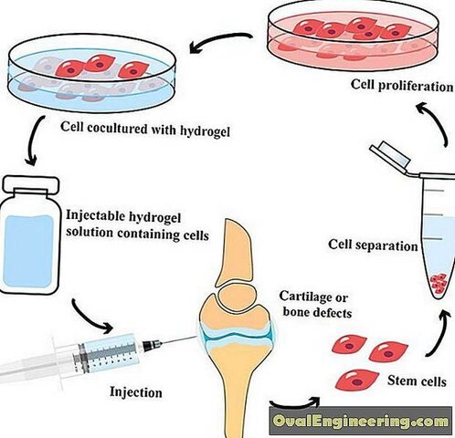 Aplicación de la impresión 3d in situ asistida por robot en la reparación de cartílago con hidrogel