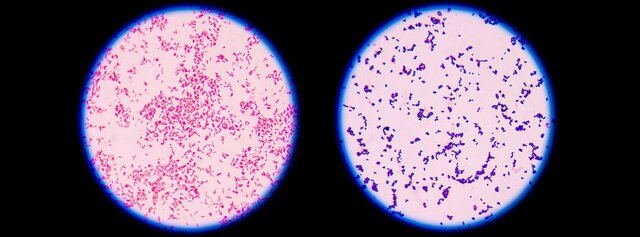 Técnica de la tinción de Gram