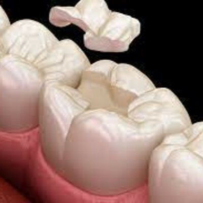 Timeline: Evolucion de la Odontologia Restauradora