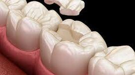 Timeline: Evolucion de la Odontologia Restauradora