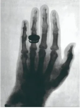 Descubrimiento de los Rayos X por Wilhelm Conrad Röntgen.