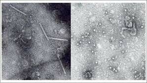 Kaushen y colaboradores