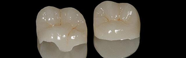 Cerámica moldeable (Dicor)