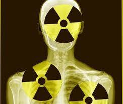 Primeros eventos adversos a la radiación