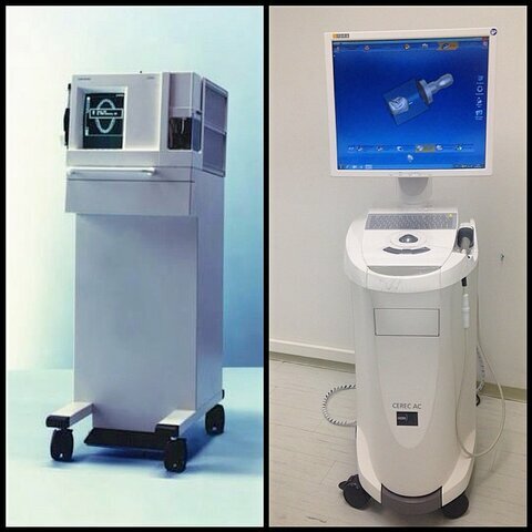 Cerec 1