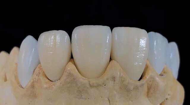 Bottger introduce el feldespato como fundente en porcelanas chinas.