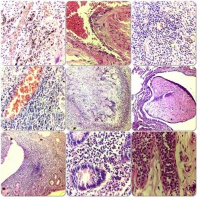 Timeline: Historia de la Anatomía Patológica