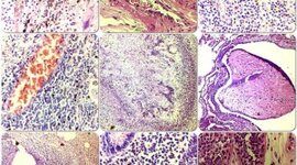 Timeline: Historia de la Anatomía Patológica