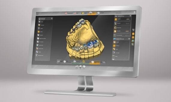 Se estableció el sistema Cerec inLab MC XL CAD/CAM para fabricar una variedad de restauraciones
