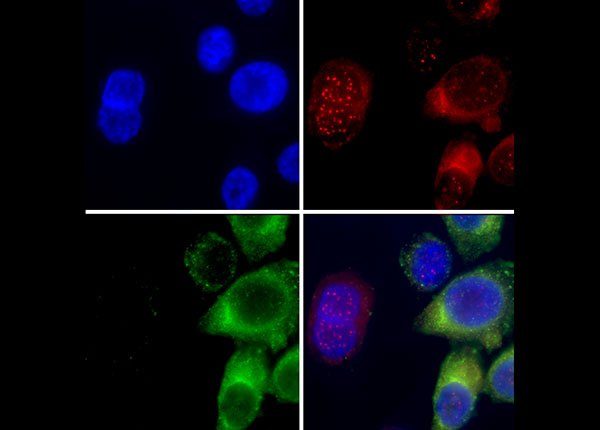 August Köhler y Moritz von Rohr
