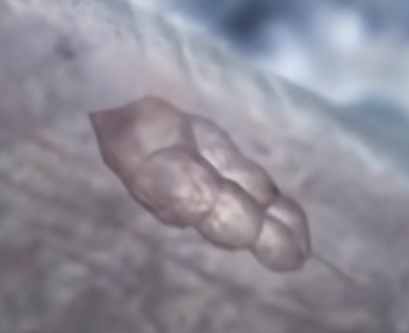 FORMACIÓN DEL CEREBRO