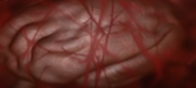 EVOLUCIÓN DEL CEREBRO