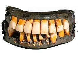 Coronas de porcelana