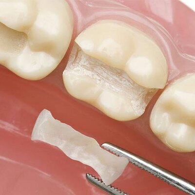 Timeline: La Evolución de la Odontología Restauradora hasta la Actualidad