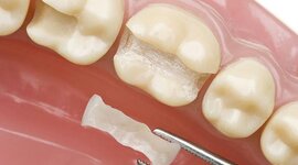 Timeline: La Evolución de la Odontología Restauradora hasta la Actualidad