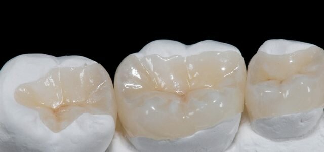 Incrustación de cerámica