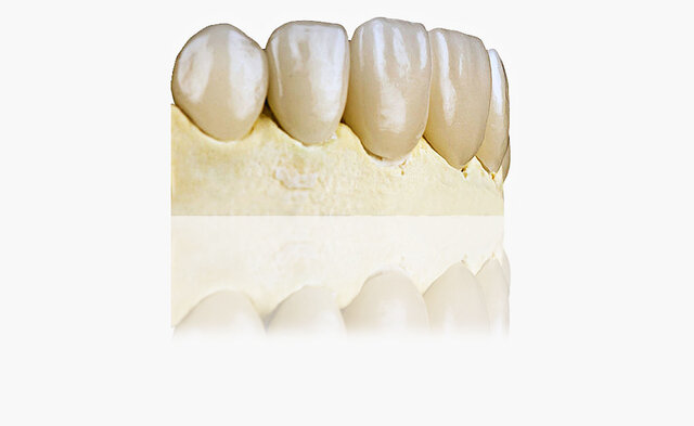 Cerámica calcinable