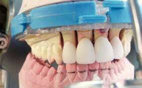 Espinela en cerámica