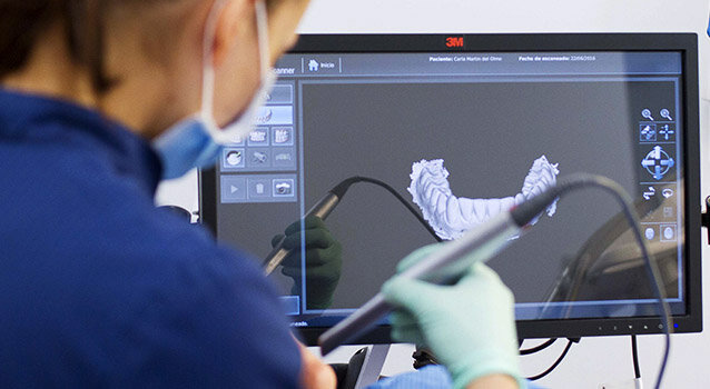 Escáner intraoral 3D