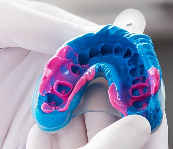 Uso de Siliconas por Adición (Polivinilsiloxano)