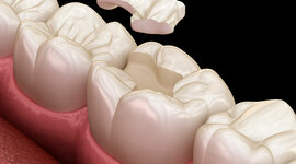 Timeline: Odontologia restauradora