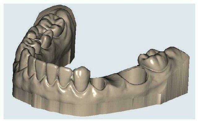 Primeros usos Tecnologías  CAD/CAM en Odontologia