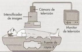Intensificador De Imágenes