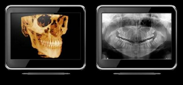 Se desarrolla el sistema de tomografía cone-beam