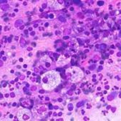 Timeline: Anatomia Patologica