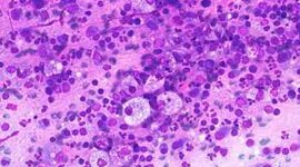 Timeline: Anatomia Patologica